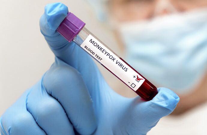 Anvisa autoriza dispensa de registro de vacinas para varíola dos macacos